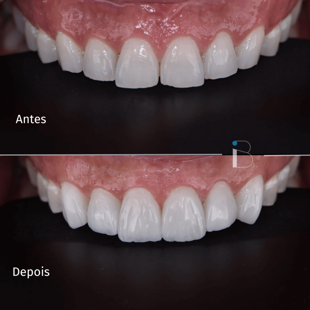 Antes e depois - Instituto Baumeier (11)